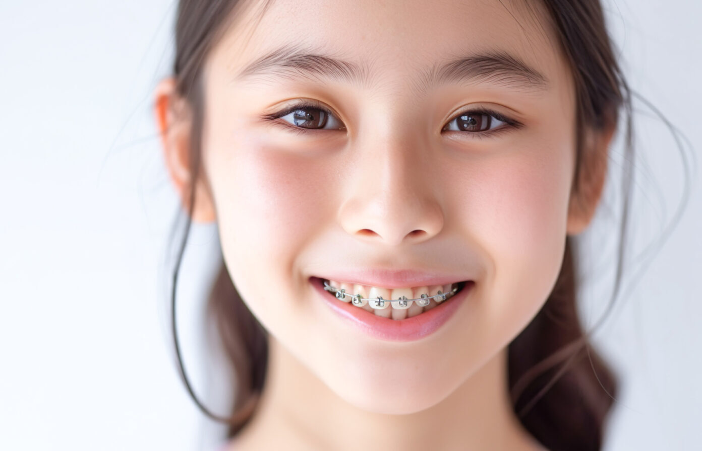 難症例にも対応する「ワイヤー矯正」